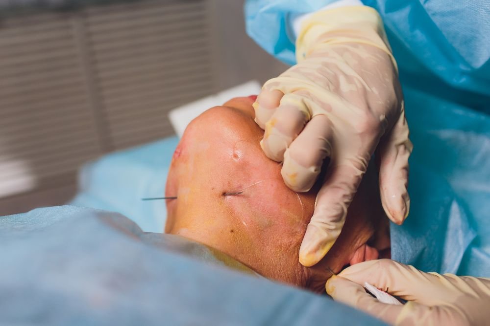 Oncology care photo